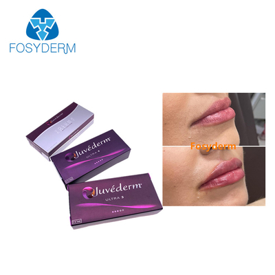 Anti Wrinkles Juvederm Dermal Lip Fillers 2*1ml Hyaluronic Acid Injection