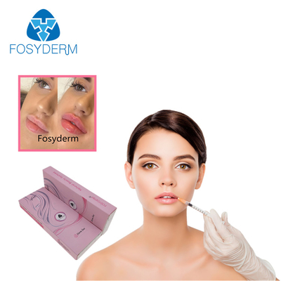 Fosyderm 2ml Lip Enhancement Injectable Dermal Fillers Hyaluronic Acid Gel Injection