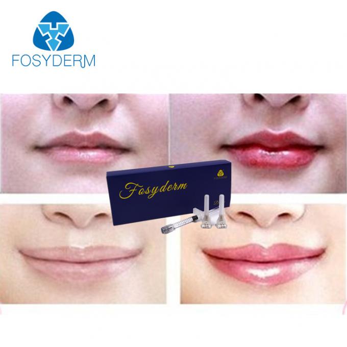 Safety Hyaluronic Acid Lip Fillers 2ml , Lip Plumping Injections Dermal
