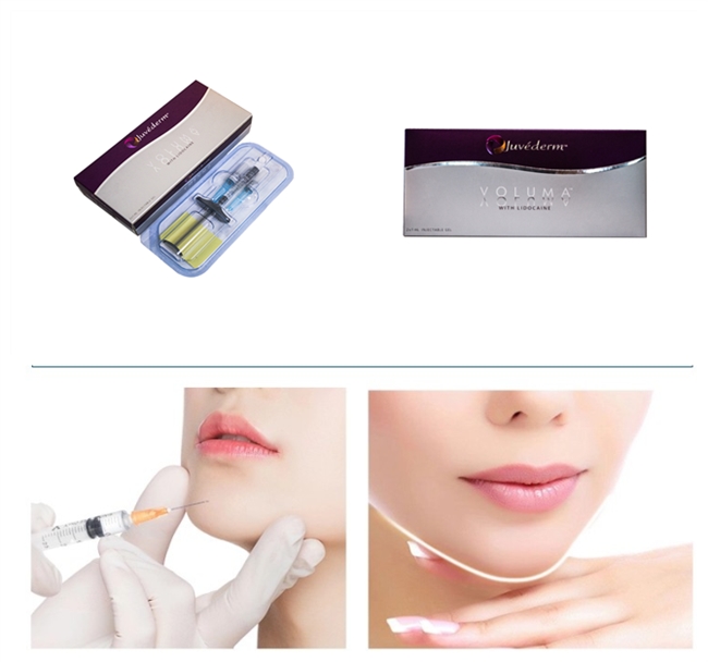 2ml Lip Injections Juvederm Hyaluronic Acid Dermal Filler