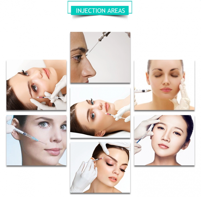Korea Cross Linked Hyaluronic Acid Skin Injections For Cheek Fullness