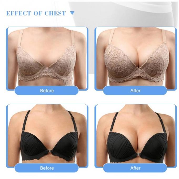 20 ml Hyaluronic Acid Dermal Filler No Swelling Breast Filler Injection