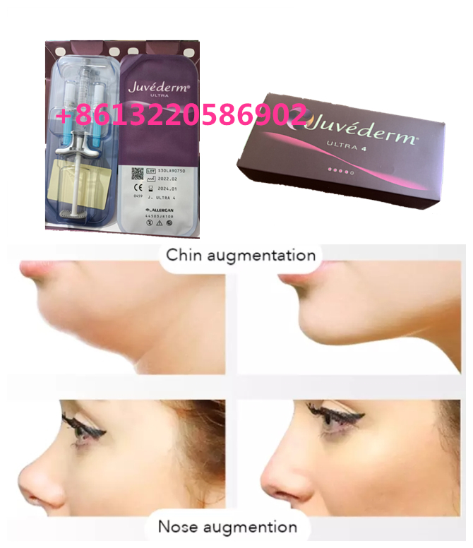 Juvederm Volbella Hyaluronic Acid Lips Filler Cross Linked 24mg