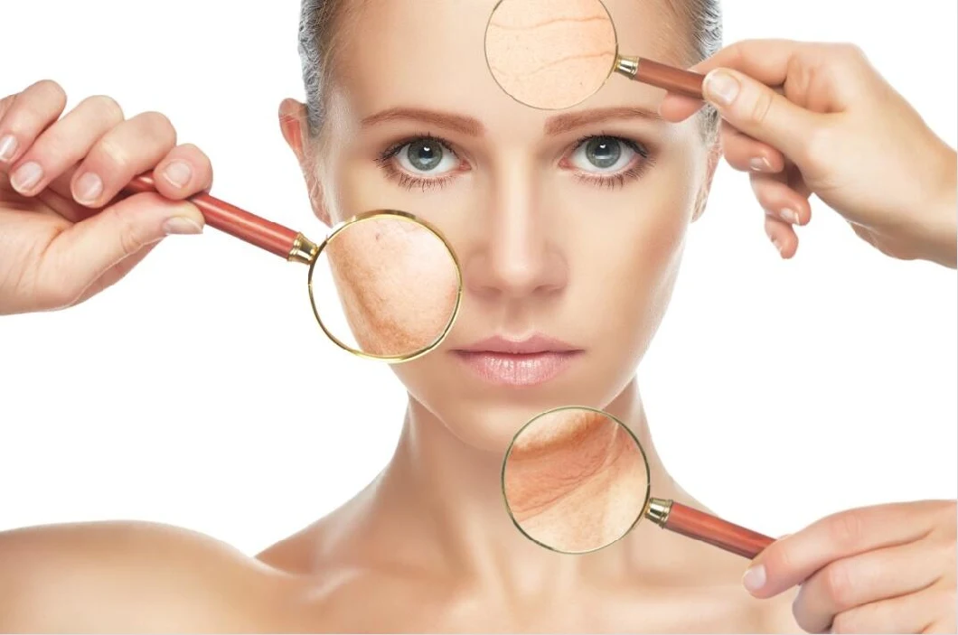 Hyamely Hyaluronic Acid Meso Solution Dermal Filler Mesotherapy Serum For Skin Care 0