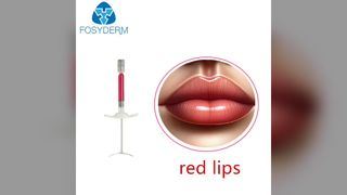 red lips
