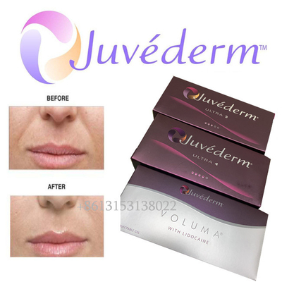 Juvederm Hyaluronic Acid Facial Filler Long Lasting Ultra3 Ultra4 Voluma Injection