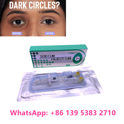 Hyamely Solution Injection For Dark Circles And Tear Trough Of Eyes