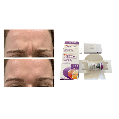 White Allergan Botulinum Toxin Anti Aging  Injection
