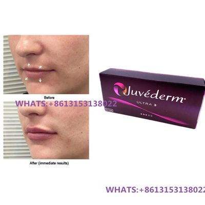 Juvederm Dermal Filler For Lips Juvederm Ultra3 Ultra4 Fillers Pre-filled Syringe