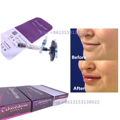 2×1ml Injectable Dermal Filler Juvederm Syringe Ultra3 Ultra4 Voluma