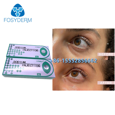 1ml Sodium Hyaluronate Composite Solution Remove Dark Circles