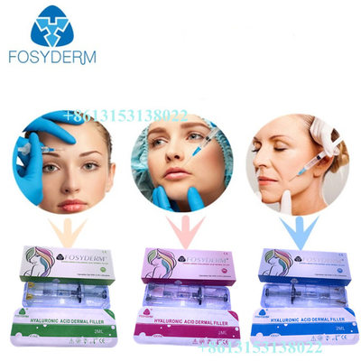 Fosyderm Dermal Filler Hyaluronic Acid Injection 24mg/ml HA For Lips CE