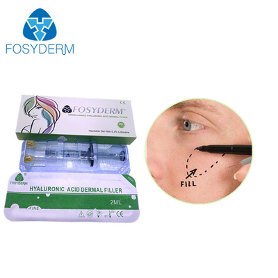 Fosyderm Dermal Filler Hyaluronic Acid Injection 24mg/ml HA For Lips CE