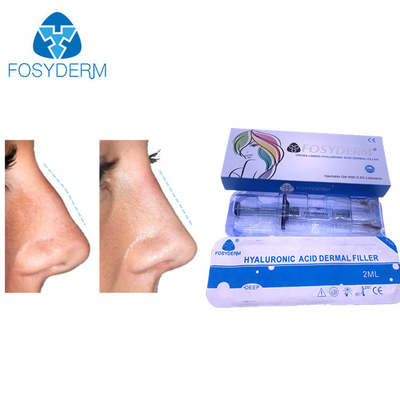 Fosyderm Dermal Filler Hyaluronic Acid Injection 24mg/ml HA For Lips CE