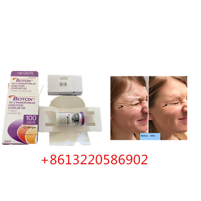 Anti Aging Allergan Botox Injection 100units Type A Anti Wrinkle