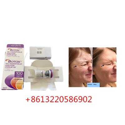 Anti Aging Allergan  Injection 100units Type A Anti Wrinkle