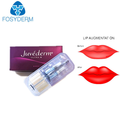 Juvederm Ultra 3 Hyaluronic Acid Dermal Filler For Face Lips