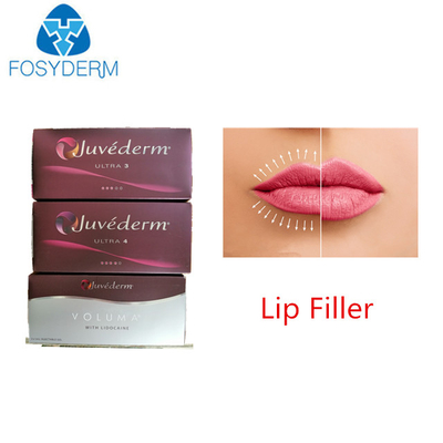 Juvederm Ultra 3 Hyaluronic Acid Dermal Filler For Face Lips