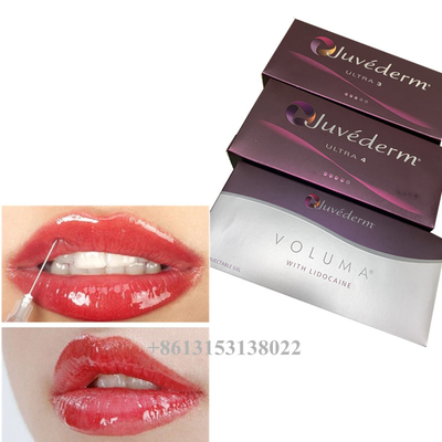 Juvederm Voluma Hyaluronic Acid Dermal Filler Gel 24mg/Ml Dermal fillers