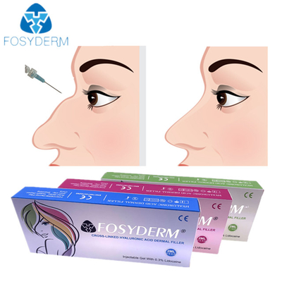 Hyaluronic Acid Dermal Nose Filler Injection 1ml 2ml For Female Using