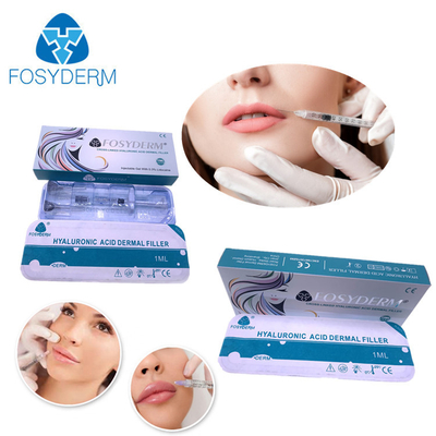 Face And Lips Fosyderm 1ml Derm Filler Removing Wrinkles