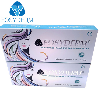 Face And Lips Fosyderm 1ml Derm Filler Removing Wrinkles