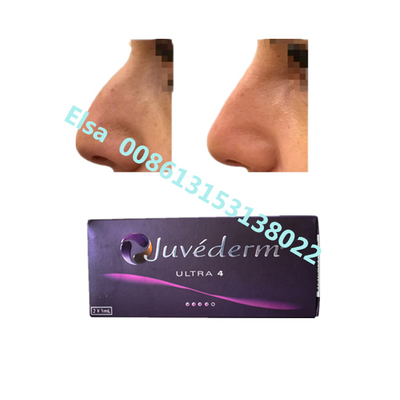 Juvederm Sodium Ultra4 Voluma Dermal Filler For Lip Chin Augmentation