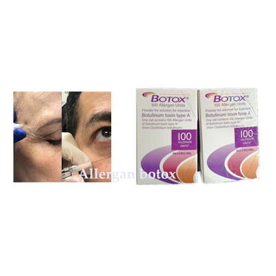 Botulinum Toxin Allergan  Injection For Wrinkle Remove