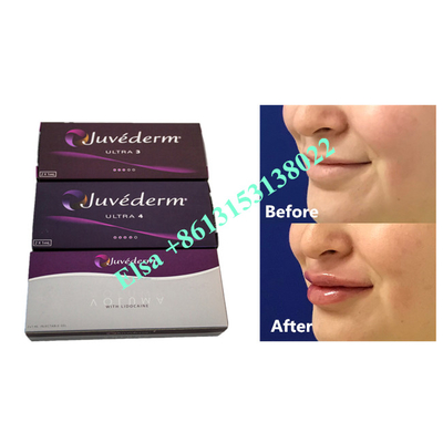 Voluma Hyaluronic Acid Fosyderm Dermal Filler Injection 24mg/Ml