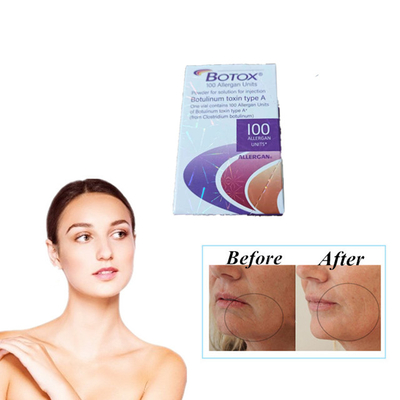 Allergan Botox 100 Units Types Botulinum Toxin Injection Anti Wrinkles