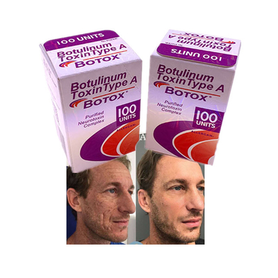 Botox Injection Powder Allergan Cosmetics Anti Aging Wrinkle 100 Units