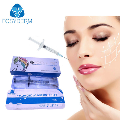 2ml Fosyderm Filler For Chin Cheeks Lips Removing Wrinkles Hyaluronic Acid