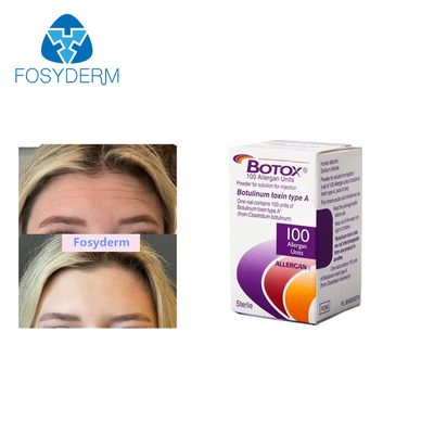 Allergan Botulinum Toxin Injections Remove Wrinkles 100 Units 