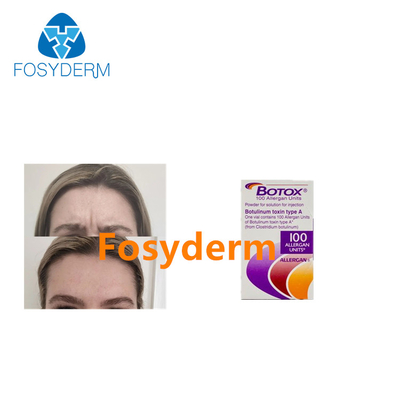 Allergan Botulinum Toxin Injections Remove Wrinkles 100 Units 