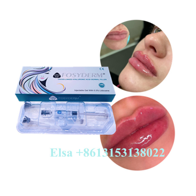 Hyaluronic Acid Gel Injection Juvederm Lip Filler Ce Anti Aging 1ml 2ml 5ml