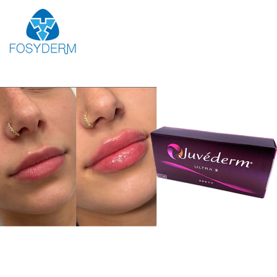 Face Care Juvederm Hyaluronic Acid Dermal Filler Cross Linked 2ml