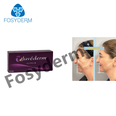 Face Care Juvederm Hyaluronic Acid Dermal Filler Cross Linked 2ml