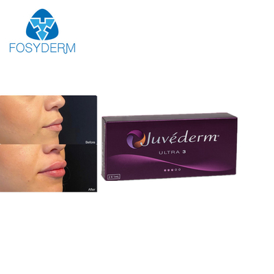 Juvederm Ultra3 2ml Cross Linked Dermal Lips Filler Hyaluronic Acid Injection