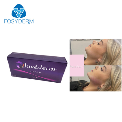 Juvederm 2ml Hyaluronic Acid Fillers Lip Enhancement