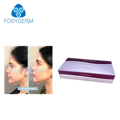 Juvederm 2ml Hyaluronic Acid Fillers Lip Enhancement