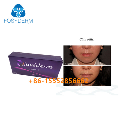 Chin Augmentation Hyaluronic Acid Facial Filler Juvederm Ultra4 Dermal 2ml