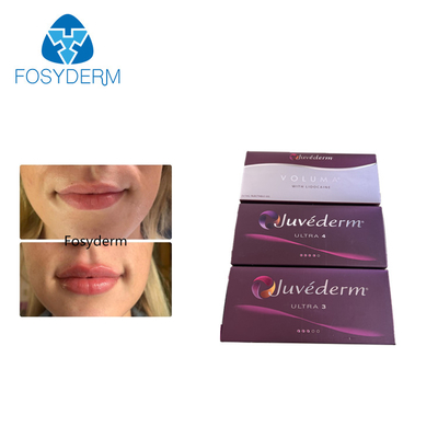 Juvederm Cross Linked 24mg 2ml Dermal Filler Hyaluronic Acid