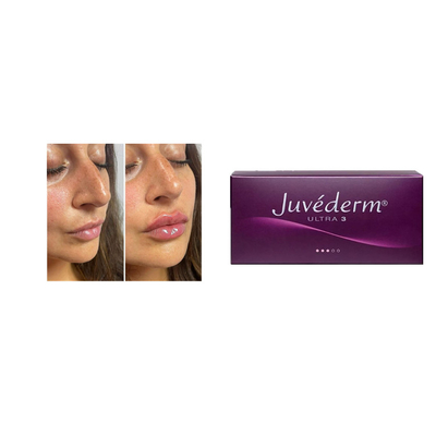 Juvederm Cross Linked 24mg 2ml Dermal Filler Hyaluronic Acid