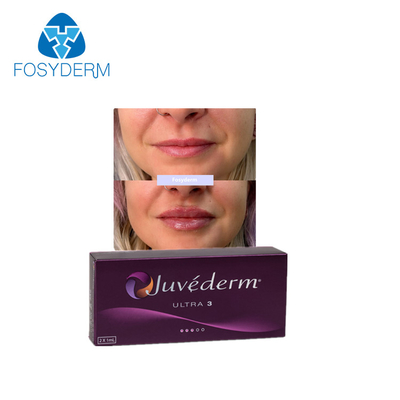 Juvederm Ultra3 Dermal Lip Fillers Cross Linked Lip Enhancement Hyaluronic Acid