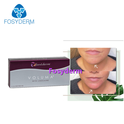 2x1ml Cross Linked Dermal Filler Juvederm Voluma For Chin Augmentation