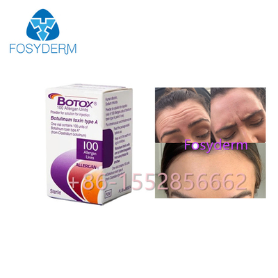 Allergan Botox 100 Units Botulinum Toxin Anti Wrinkles Type A Injection