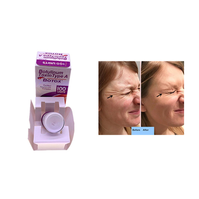  Allergan 100 Units For Wrinkles Removal Dermal Filler Injection