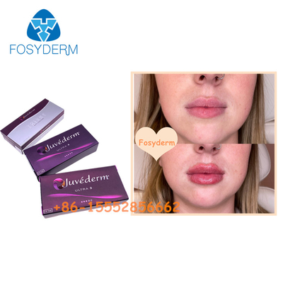 Juvederm Facial Hyaluronic Acid Dermal Filler Anti Aging Ultra3 Ultra4 Voluma