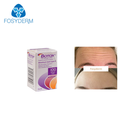 100Units Allergan Botulinum Toxion For Remove Facial Wrinkles Botox Type A