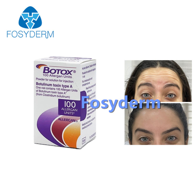 100Units Allergan Botulinum Toxion For Remove Facial Wrinkles  Type A